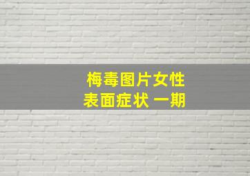 梅毒图片女性表面症状 一期